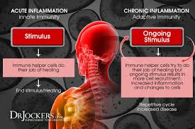 Top 7 Strategies To Support Chronic Inflammation Drjockers Com In 2020 Chronic Inflammation Inflammation Chronic