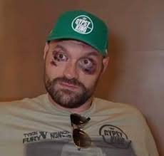 Fury has been handed a HUGE advantage just hours before the fight. It's  official! 😳