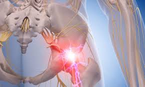 Acupuncture For Sciatica Wisdom Traditions Acupuncture Essex Vt