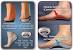 Custom Orthotics