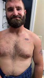 Emily's Scar and Plastic Surgery