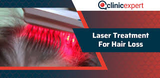My hair loss was devastating to me. Laser Treatment For Hair Loss Clinicexpert International Healthcare