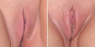 Erregte vagina
