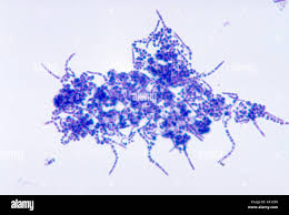 Image result for Landolphia congolensis