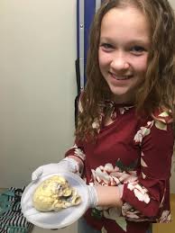 Nick Ripke was born with a defective heart and waited years for a  transplant. His parents, from Menomonee Falls, brought him home from China  when he was just 2 years old. Nick's