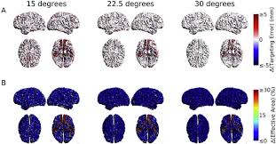 4 downloads 79 views 511kb size. Accessibility Of Cortical Regions To Focal Tes Dependence On Spatial Position Safety And Practical Constraints Sciencedirect