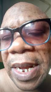 How to stop a brake failed motorcycle.