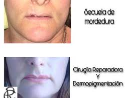 La cirugía plástica está muy relacionada con la búsqueda de la belleza, repercutiendo en la. Clinicas De Cirugia Maxilofacial En Jujuy Esteticas Com Ar
