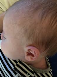 If you're quick and thorough with diaper changes and burp cloths, you're already cleaning with your free hand gently massage a drop of mild baby shampoo into your baby's scalp. Dry Scalp February 2019 Babies Forums What To Expect