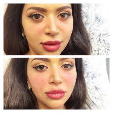 We did not find results for: Jawlineaugmentation Instagram Posts Photos And Videos Picuki Com