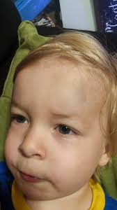 Husband finds cool bandages for child