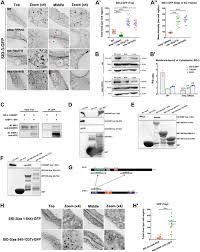 You can go down two routes. An Ehbp 1 Sid 3 Dyn 1 Axis Promotes Membranous Tubule Fission During Endocytic Recycling