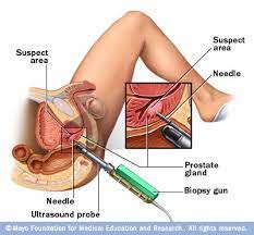 Maybe you would like to learn more about one of these? Image Guided Needle Biopsy Mayo Clinic