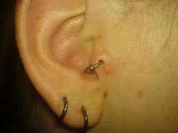 It is enriched with over 82 minerals and elements, and it also has a perfectly balanced ph. Infected Tragus Piercings Symptoms Treatment Authoritytattoo