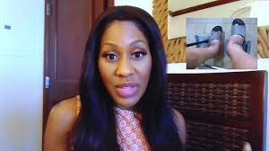 Anyone know of a cure for Lymphedema in right arm please.