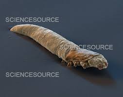 Image result for Demodex folliculorum