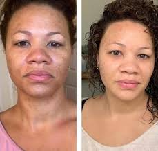 ODW vs Midnight Oil Serum One Drop Wonder Is one of our serums made with  Pomifera Oil. It helps with numerous skin conditions