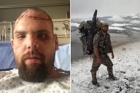 Man Who Escaped After Bear Crushed His Skull