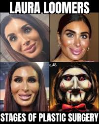 As soon as the movie finished, I ended up having some plastic surgery."