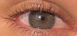 We're not talking about perspective, but. Irex Laser On Twitter Before And After Laser Permanent Eye Color Change Reveal Your True Blue Green Eyes To The World Irexlaser World Laser Eyecolorchange Https T Co 9ndiwikkpk