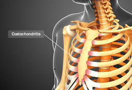 Sometimes chest pain feels crushing or burning. Surprising Causes Of Chest Pain