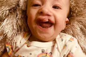 Fundraiser by Kathleen Taylor : Paislee's life saving heart surgery