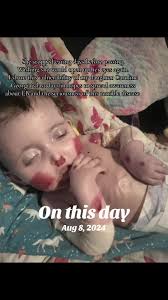 Understanding EB: A Journey of Awareness and Love