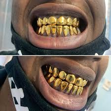 Maybe you would like to learn more about one of these? 20 Wall Action 10t 10b Dental Gold Wall2wall Grillz Facebook