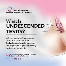 Image result for Undescended Testicle