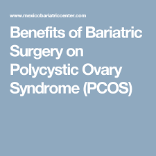 Pin On Bariatric Surgery