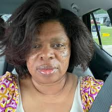 What is McKinney missing?