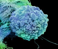 Cancerians are totally angered by not being taken seriously and having others hurt their feelings. Fda Clears First Cancer Drug Based On Genetics Of Disease Not Tumor Location Scientific American
