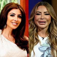 My 600-lb Life Season 5 Episode 11 Discussion and Reactions