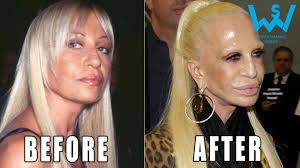 Worst Celebrity Plastic Surgery Disasters Plastic Surgery Fails Bad Celebrity Plastic Surgery Celebrity Plastic Surgery Plastic Surgery Fail