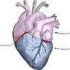 Cadaver practicals, heart, anterior view. Https Encrypted Tbn0 Gstatic Com Images Q Tbn And9gct2nwwvliscnyluibkzvwc8wi5s1udascrrgthhdcpu33wnmdrr Usqp Cau
