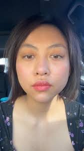 Review video 1 of 1 for Beverly Hills Rejuvenation Center-Huntington Beach