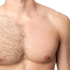 Laser hair removal is an expensive process and i took out a loan in order to receive my services. Switch To Laser An Ideal Choice For Perfect Hair Free Solutions Pause Online Men S Fashion Street Style Fashion News Streetwear