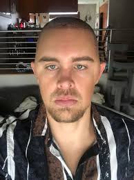 Help! I think I'm allergic to something, can anyone with medical experience  assist?