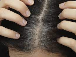 However, you can treat white hair by following some simple and inexpensive ways. 10 Natural And Best Home Remedies To Reduce White Hair