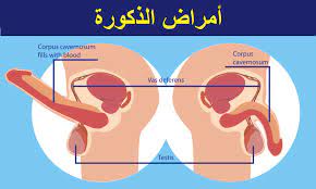 الأستفسار بخصوص أمراض الذكورة هرمون التستوستيرون البروستاتا التهاب البربخ الخصية
