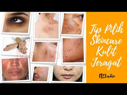 Produk keluaran naruko ni, bantu mencerahkan, melembapkan dan melegakan kulit muka. Tips Pilih Skincare Kulit Jeragat By Nurul Aziyana