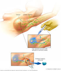 The problem with cancer lies in its early detection. Breast Cancer Diagnosis And Treatment Mayo Clinic