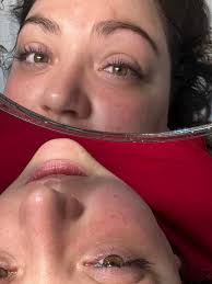 Dermaplaning Facial
