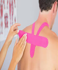 Understanding Kinesio Tape