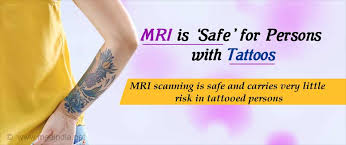 Doctors also treat arrhythmias with implantable cardioverter defibrillators (icds). Is It Safe To Perform Mri In Tattooed Persons