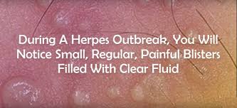 This is because of skin folds in these areas, which makes the type used depends on hair and skin type. Ingrown Hair Infected Ingrown Hair Cyst In Pubic Area