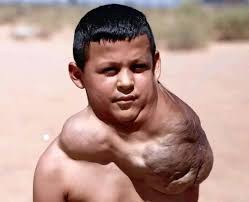 Today is my birthday, because my condition is like this, no one wishes me a  birthday😥😥 I feel so lonely ☹️