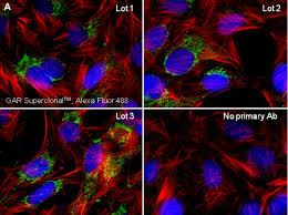 Control iggs and igg conjugates. Igg H L Goat Anti Rabbit Alexa Fluor 488 Superclonal 1 Mg Alexa Fluor 488 Sekundarantikorper Ziege Anti Kaninchen Fisher Scientific