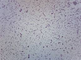Image result for Shigella