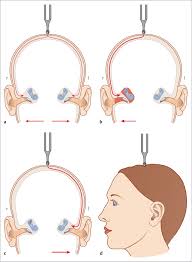 Image result for Whispered Voice Testing